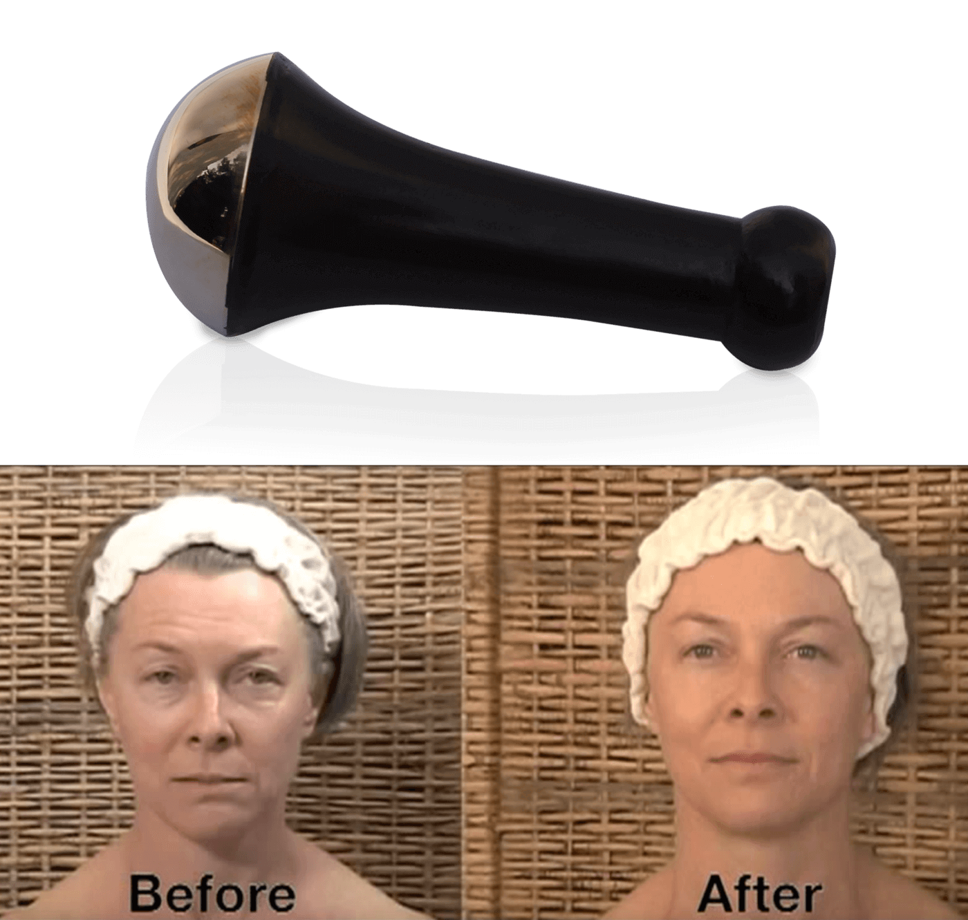 Deep Stress Relief with Kansa Wand on Scalp and Neck