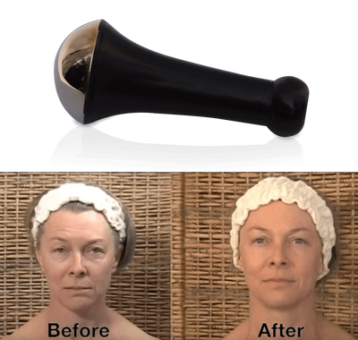 Deep Stress Relief with Kansa Wand on Scalp and Neck